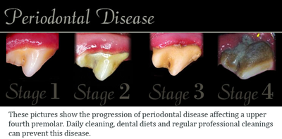Dental Disease